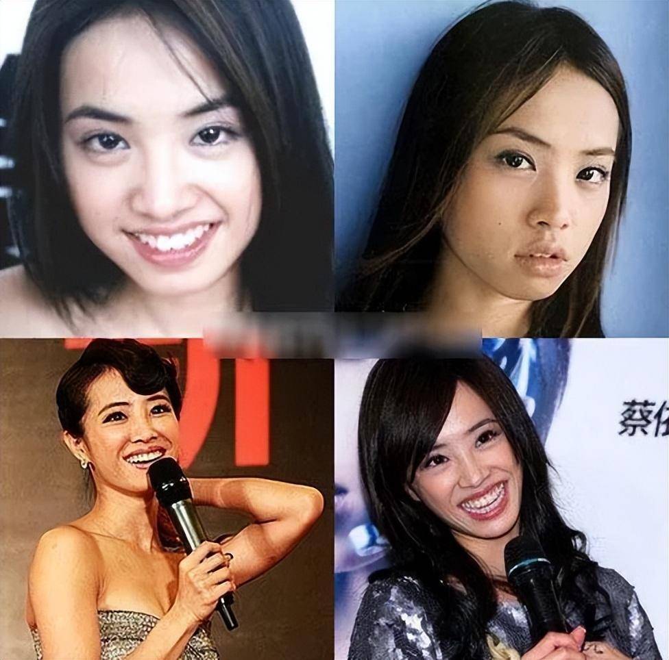 娱乐圈整容明星_女明星整容吗_鞠婧祎四千年美人整容真相