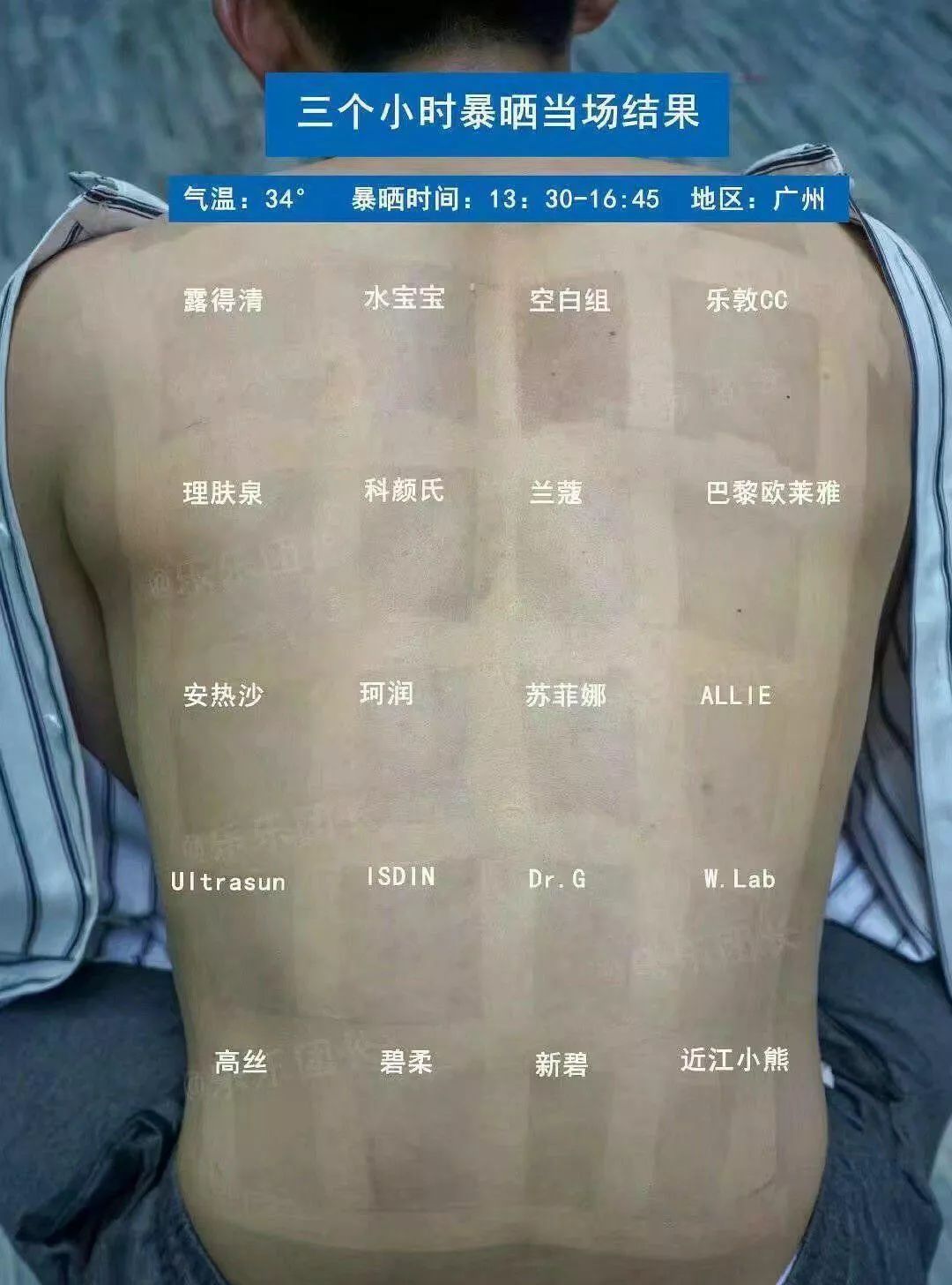 女明星着装拼了_宋轶防晒方法_女明星防晒招数